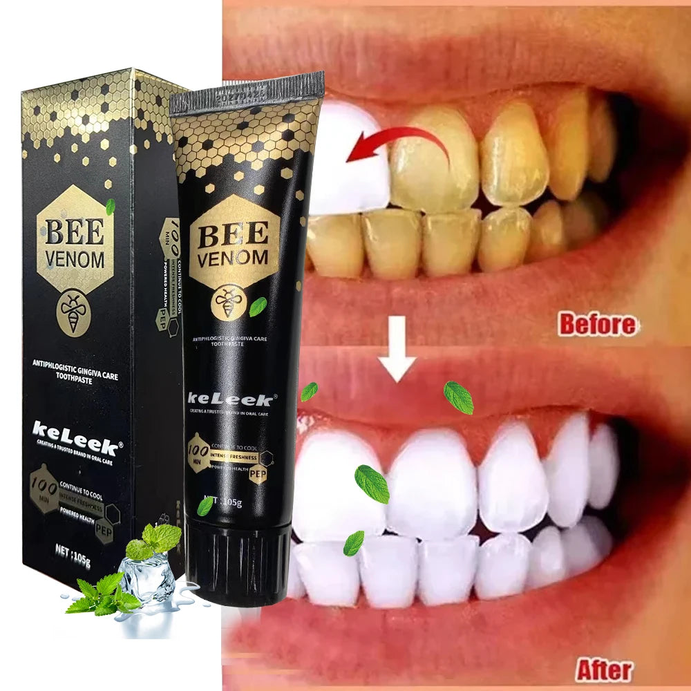 Pasta de dientes Dreamblue 3 Bee Venom Protect Gums, blanqueadora y fresca para adultos, cuidado bucal profundo y eliminación de manchas